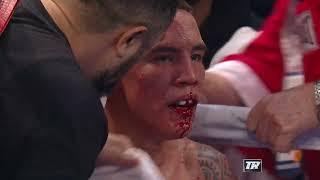 "I COULDN'T EAT OR DRINK FOR AWHILE" | Oscar Valdez Recounts The Time He Broke His Jaw Against Quiqq